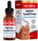 Treatonic Ingrown Toenail Treatment - Ingrown Toenail Pain Reliever and Softener Kit for Easy Trimming with Silicone Gel Toe Caps