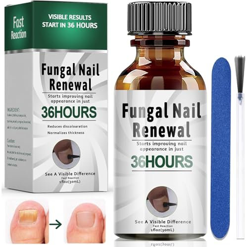30ML Traitement des ongles incarnés,Traitement Ongles,Favorise la Repousse D'ongles Sains,Régénére et Renforce l'Ongle,Pinceau Applicateur+Lime à Ongles,Solution Pour Les Ongles Décolorés, Émiettés