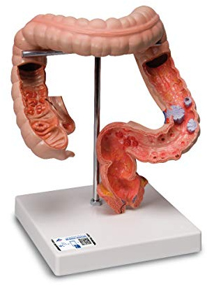 3B Scientific Dickdarm-Modell, K55