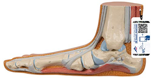 3B Scientific Menschliche Anatomie - Modell - Plattfuß (Pes planus) + kostenlose Anatomie App - 3B Smart Anatomy