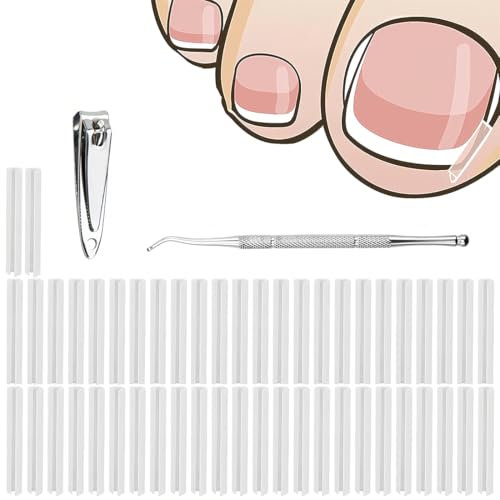 CATOR 50 Kit correcteur d'ongles incarnés - bandes de redressement d'ongles indolores avec lève-ongles - Kit d'outils pour ongles incarnés facile à utiliser mit coupe ongle