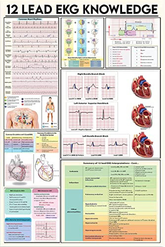 12-Kanal-EKG-Wissen, Metall-Blechschild, Retro-Stil, Kunstwerk, Infografik, Analyse, für Club, Zuhause, Büro, Klassenzimmer, Wohnzimmer, Leitfaden, Referenztabelle, Wanddekoration, 40,6 x 30,5 cm