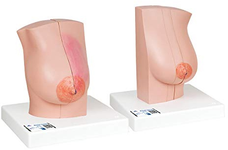 3B Scientific® Weibliches Brustmodell – Humananatomie-Lehrmodell mit inneren Strukturen, Langlebiges PVC + Smart Anatomy App (5 Jahre Garantie)