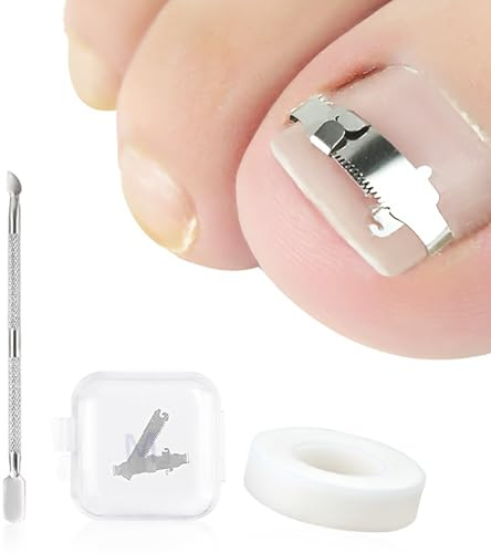 Ferizzia 3 Stück Eingewachsene Zehennägel Set, Nagelspange Fußnägel | Zehennagel Korrektur, Edelstahl Maniküre Pediküre Set, für Eingewachsene Nägel und Nagelbettentzündung