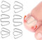 Correctoras Uñas Encarnadas,Gancho de Corrección de Uñas Herramienta para Uñas Encarnadas Tiras Correctoras de Uñas Elevador de Alambre Herramienta de Recuperación para Mujeres Hombres Corrector