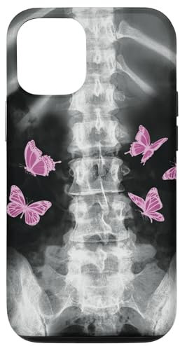 iPhone 15 Egirl Xray Skeleton Pink Butterfly Harajuku y2k Dark Grunge Case