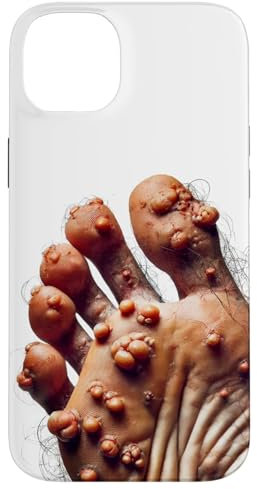 Ugly Feet Case Hülle für iPhone 14 Plus Lustiges hässliches Cringe Phone, Polycarbonat und TPU, Robuster Schutz, Bunt, Phone Case