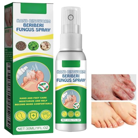 Anti-fongique foot Spray, Spray Contre Les Mycoses Des Pieds, Mycose Pied Foot Care pour athlètes, les Démangeaisons, la Transpiration, l'Écaillage et les Ampoules, Rafraîchissant,Apaisant et Calmant
