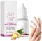Fungigone Nail Treatment, Fungigone Nail Fungus Removal, Natural Ginger Nail Essence for Repair & Protect, 7 Days Nail Fungus Treatment For Toenail and Fingernail, Fungal Nail Treatment (1)