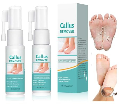 Hornhautentferner, hornhaut reduzierspray, extra starkes Spray, Fuß-Hornhautentfernungsspray für Fersenschwielen, Fußhornhautentferner, abgestorbene Haut und Schwielen an Füßen (20ml, 2PC)