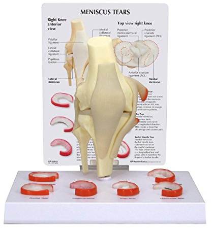GPI Anatomicals 1010 Meniskus-Kniemodell mit 6 Rissen