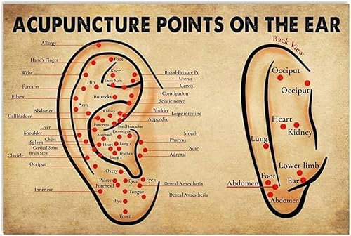Metallschilder zum Thema Ohranatomie, Wanddekoration, Aluminiumschild, Akupunkturpunkte am Ohr, Poster, Ärzte, Populärwissenschaft, Infografik, Plaketten, Krankenhaus, Klinik, Zimmer, Büros, 20,3 x 30