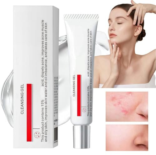 15% Acid Acne Treatment Gel,Anti Acne Face Cream,Face Acne Treatment,Acid 15% Facial Serum Cream,Spot Treatment,Gentle Acne Cream,Spot Serum Cream for Face,Pimple Treatment Gel Cream,Face Gel for Acne
