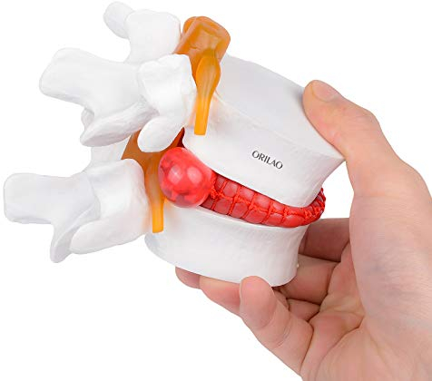 ORILAO Anatomisches Lendenwirbelsäulen-Modell 1:1,5, weiß, für Studium und Demonstration
