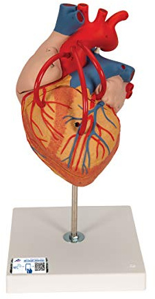 3B Scientific Menschliche Anatomie - Herz mit Bypass, 2-fache Größe, 4-teilig + kostenlose Anatomie App - 3B Smart Anatomy, G06