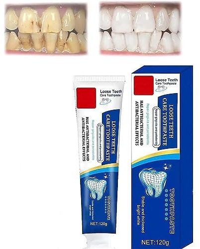 Anshka Consentbil Repair Zahnpasta, Ginseng-Propolis-Zahnpasta, Tiefenreinigung, Zahnreparatur, Zahnaufhellung, frischer Atem (1 Stück)