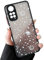 ZTOFERA Handyhülle Kompatibel mit Xiaomi Redmi Note 11 / Note 11S 4G (6,43 Zoll) Hülle, Planet Sterne Universum Muster Schutzhülle Matt Harte PC Rückseite Hülle mit Silikon Bumper Cover, Weiß Sky