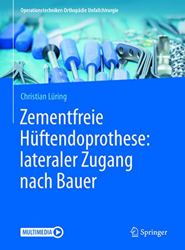 Zementfreie Hüftendoprothese: lateraler Zugang nach Bauer (Operationstechniken Orthopädie Unfallchirurgie)