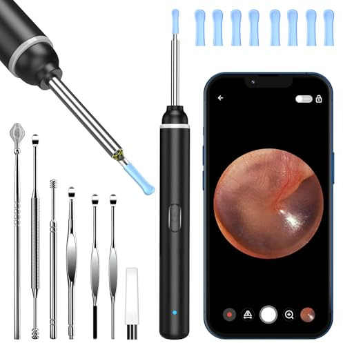 Ear Wax Removal Kit, 1920P HD Ear Cleaner with Camera Ear Wax Remover Tool | WiFi Otoscope with 6 LED Lights & 8 Ear Spoons, Visual Ear Scope for iPhone iPad Android Adults Pets(Black)