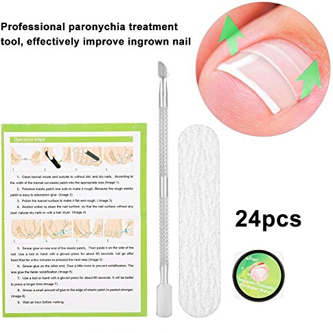 Semme Professionelle Nagel-Korrektur-Aufkleber, Pediküre Paronychie wiederherstellen Eingewachsene Zehe Nagel Maniküre Clipper Fixer Spezielle Pediküre Werkzeuge Fuß CareTool Kit(24Pcs)