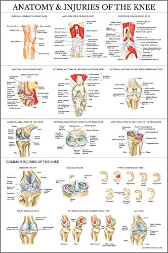 Poster, laminiert, Anatomie und Knieverletzungen, 45,7 x 68,6 cm