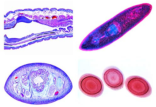 LIEDER Biologie Mikroskopie Mikropräparate Serien_ Schwämme und Hohltiere (Coelenterata, Porifera)