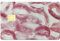 CREATCABIN Lippenabdrücke Kreditkarten Skins Debitkarten Skin Aufkleber Blasenfrei Schmal Personalisierte Bankkarten Schutzaufkleber PVC Wasserdicht Für Transport Schlüssel Geschenkkarte 18.6x13.7cm