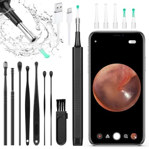 ACWOO Otoscope Oreille, Nettoyant Oreille Otoscope, 5040P HD Kit Camera Oreille D'élimination Du Cérumen Avec 6 Lumières Led, Outil De Nettoyage D'oreille De 3,5 Mm, Adapté Aux iOS et Android (Noir)