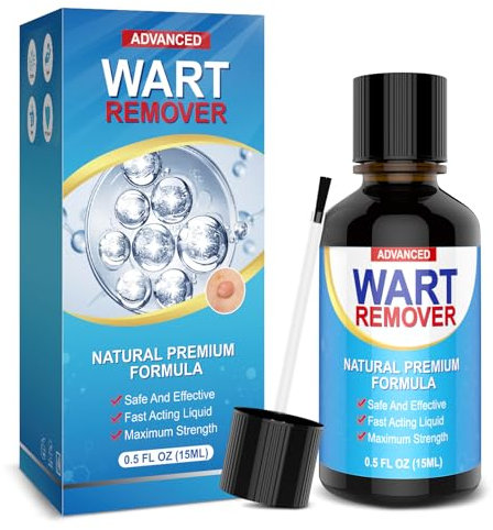 Suuprone warzenentferner,stielwarzen entferner,hühneraugen entferner,dornwarzen entfernen fuß,Natürliche pflanzliche Kräuterextrakte,sanfte warzen entfernen,schmerzfrei und narbenfrei 15 ml