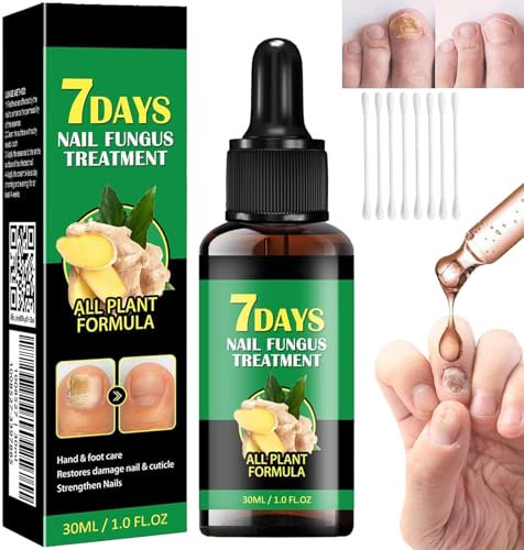 Nail Fungus Treatment,7 days Ginger Nail Fungus Treatment,Toenail Cuticle Care Oil Care,Multi-Purpose Nail Repair (30 ml (Pack of 1))