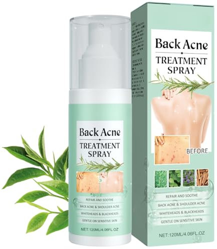 Back Acne Treatment - Acne Treatment Spray for Back & Body – Tea Tree Oil Anti-Blemish Mist for Back, Body, Chest – Fast-Acting Acne Treatment for Spots & Marks, Hydrating Body Spray