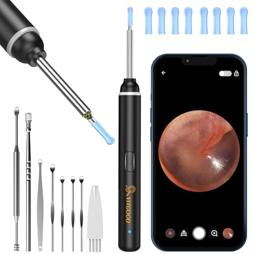 VITCOCO Otoscopio, 1920P 3,5mm Pulizia Orecchie, Pulisci Orecchie con 6 Luci LED, Orecchio Pulito per iPhone iPad e Android(Nero)