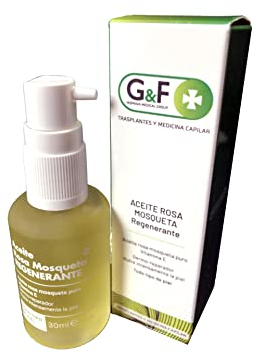 Olio di rosa muscheta per cicatrici. Olio di Rosa Mosqueta puro Vitamina E. Flacone da 30Ml. Olio per il corpo rigenerante e cicatrizzante. Per tutti i tipi di pelle. Dermo riparatore. Rosa muscheta.